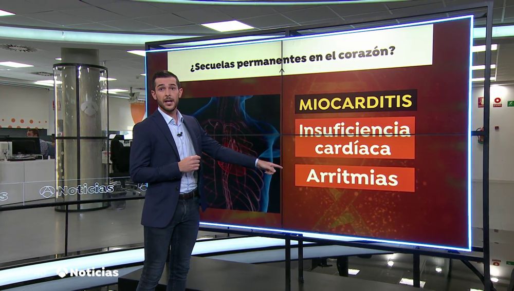 El coronavirus puede dejar secuelas irreversibles en el corazón como la miocarditis