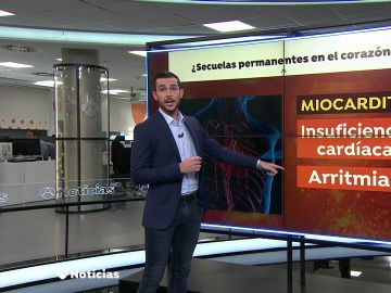 El coronavirus puede dejar secuelas irreversibles en el corazón como la miocarditis