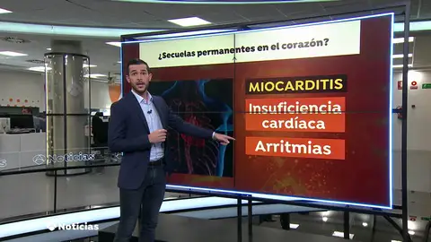 El coronavirus puede dejar secuelas irreversibles en el corazón como la miocarditis El coronavirus puede dejar secuelas irreversibles en el corazón como la miocarditis