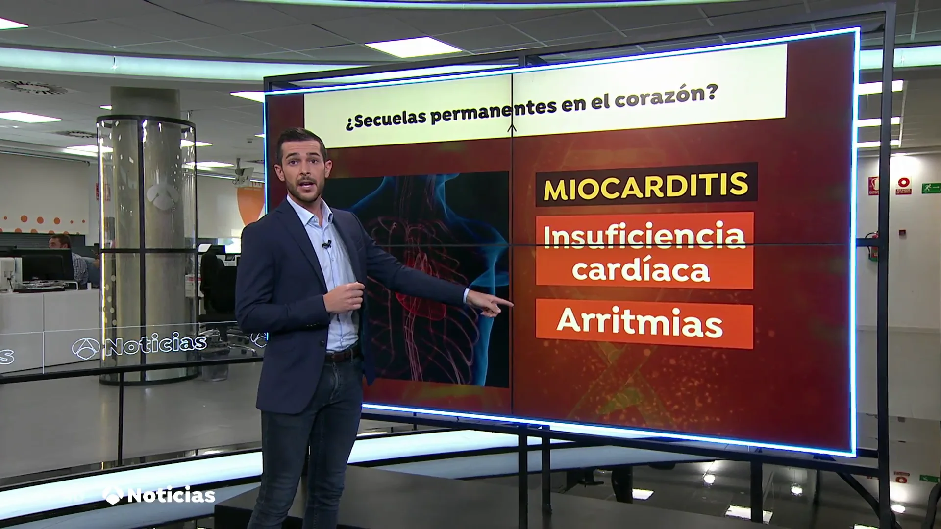 El coronavirus puede dejar secuelas irreversibles en el coraz&oacute;n como la miocarditis