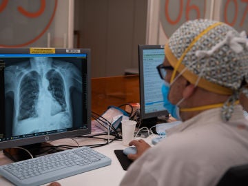 personal sanitario viendo una radiografía de pulmón