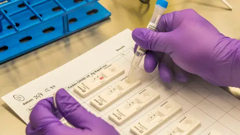 Enfermeros piden regular el precio de los test de antígenos Enfermeros piden regular el precio de los test de antígenos