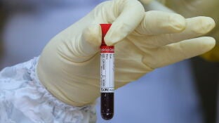 Un cient&iacute;fico sostiene una muestra de sangre
