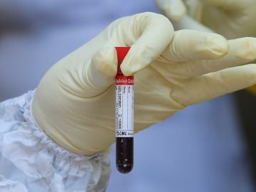 Un científico sostiene una muestra de sangre