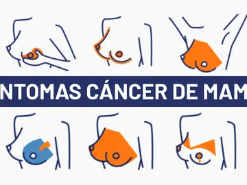Día del cáncer de mama 2020: 5 síntomas del cáncer de mama para una detección temprana Día del cáncer de mama 2020: 5 síntomas del cáncer de mama para una detección temprana