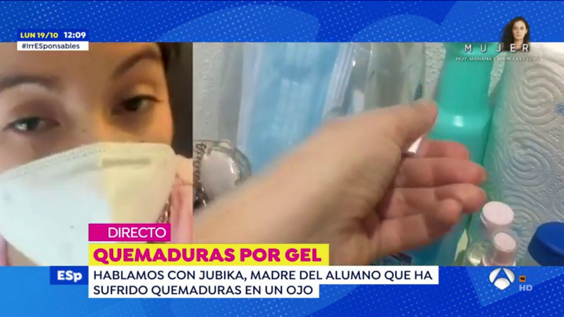 La madre del ni&ntilde;o de 3 a&ntilde;os que ha sufrido quemaduras por gel en Lal&iacute;n: "Tiene la membrana del ojo quemada y una &uacute;lcera"