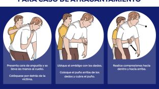 Maniobra de Heimlich