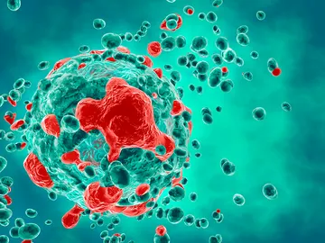 Un equipo de investigación de la Hispalense ha conseguido dar nuevos pasos en el proceso de búsqueda de un remedio para esta enfermedad Un equipo de investigación de la Hispalense ha conseguido dar nuevos pasos en el proceso de búsqueda de un remedio para esta enfermedad