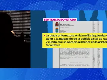Sentencia bofetada Sentencia bofetada