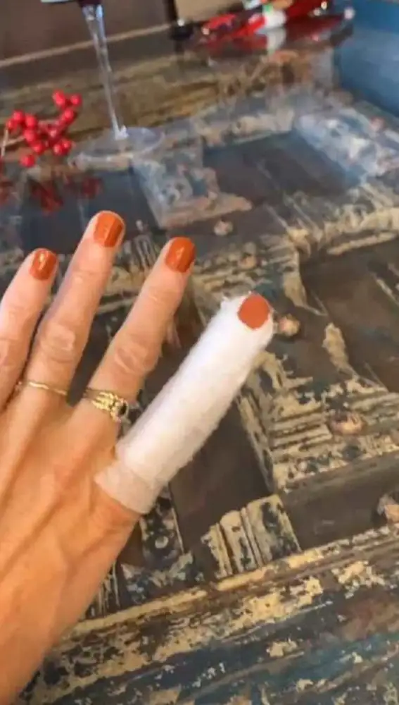 Paz Padilla muestra la lesión que ha sufrido mientras cocinaba Paz Padilla muestra la lesión que ha sufrido mientras cocinaba