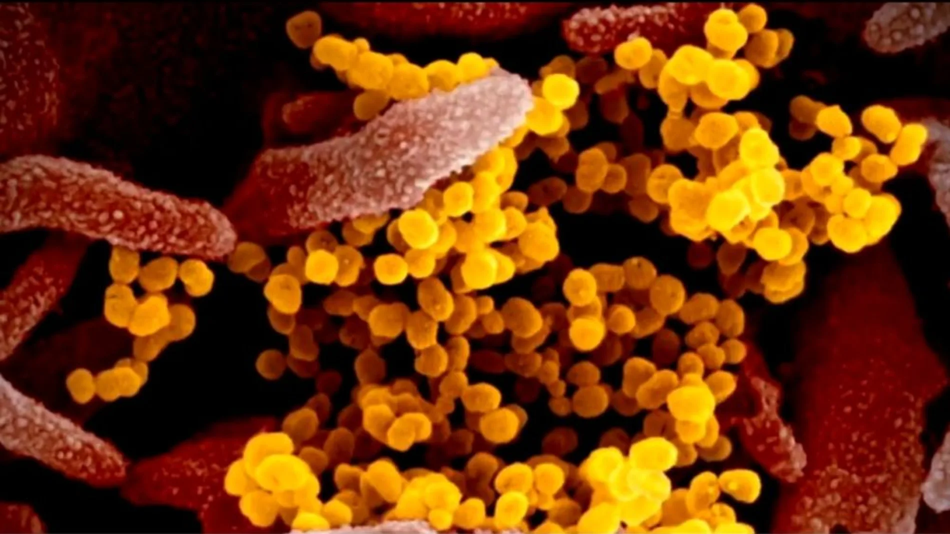 A3 Noticias Fin de Semana (20-12-20) La nueva cepa de coronavirus, ya extendida por Reino Unido, acelera hasta un 70% más su transmisión A3 Noticias Fin de Semana (20-12-20) La nueva cepa de coronavirus, ya extendida por Reino Unido, acelera hasta un 70% más su transmisión