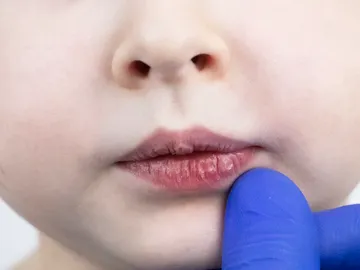 Labios secos Labios secos