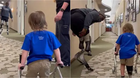 Blake Leeper enseña a andar a un pequeño con una prótesis Blake Leeper enseña a andar a un pequeño con una prótesis