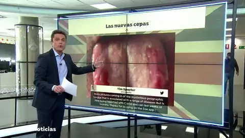 La 'lengua Covid', el nuevo síntoma que presentan algunas personas contagiadas por coronavirus La 'lengua Covid', el nuevo síntoma que presentan algunas personas contagiadas por coronavirus