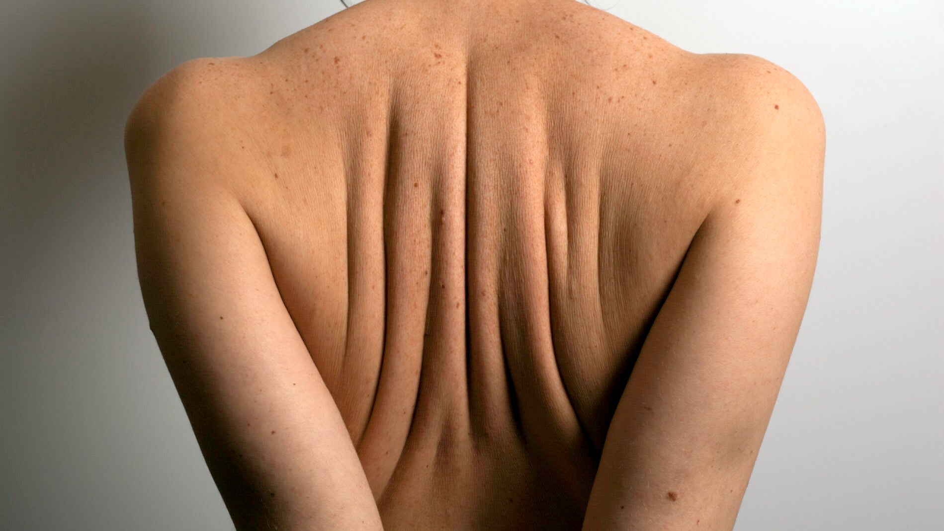 Lunares y puntos rub&iacute;