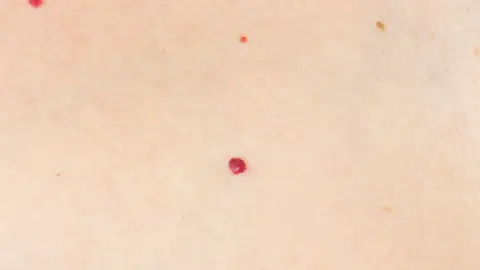 Puntos rubí Puntos rubí