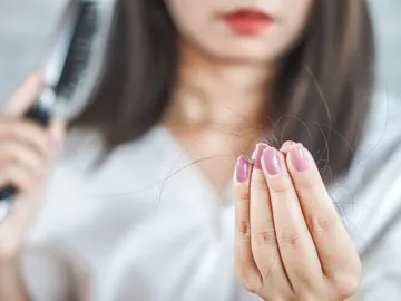 Pérdida de pelo Pérdida de pelo