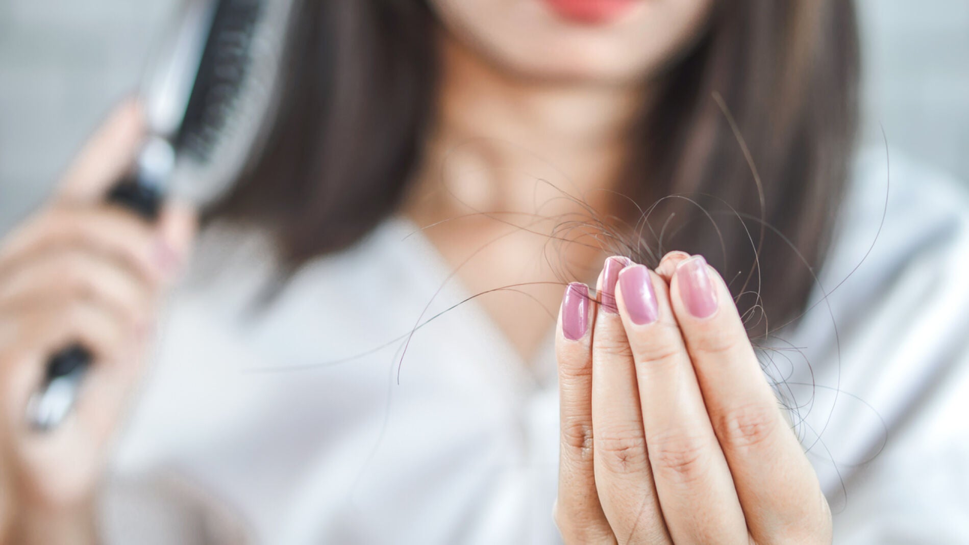 P&eacute;rdida de pelo