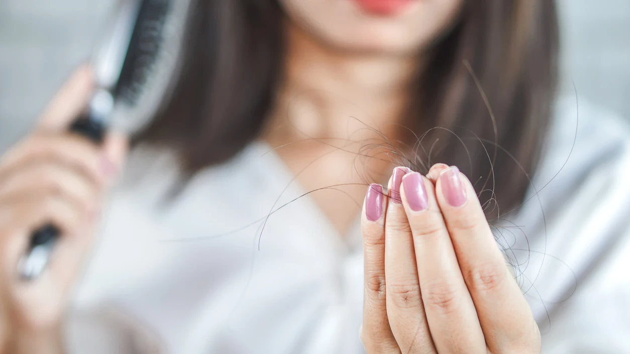 Pérdida de pelo Pérdida de pelo