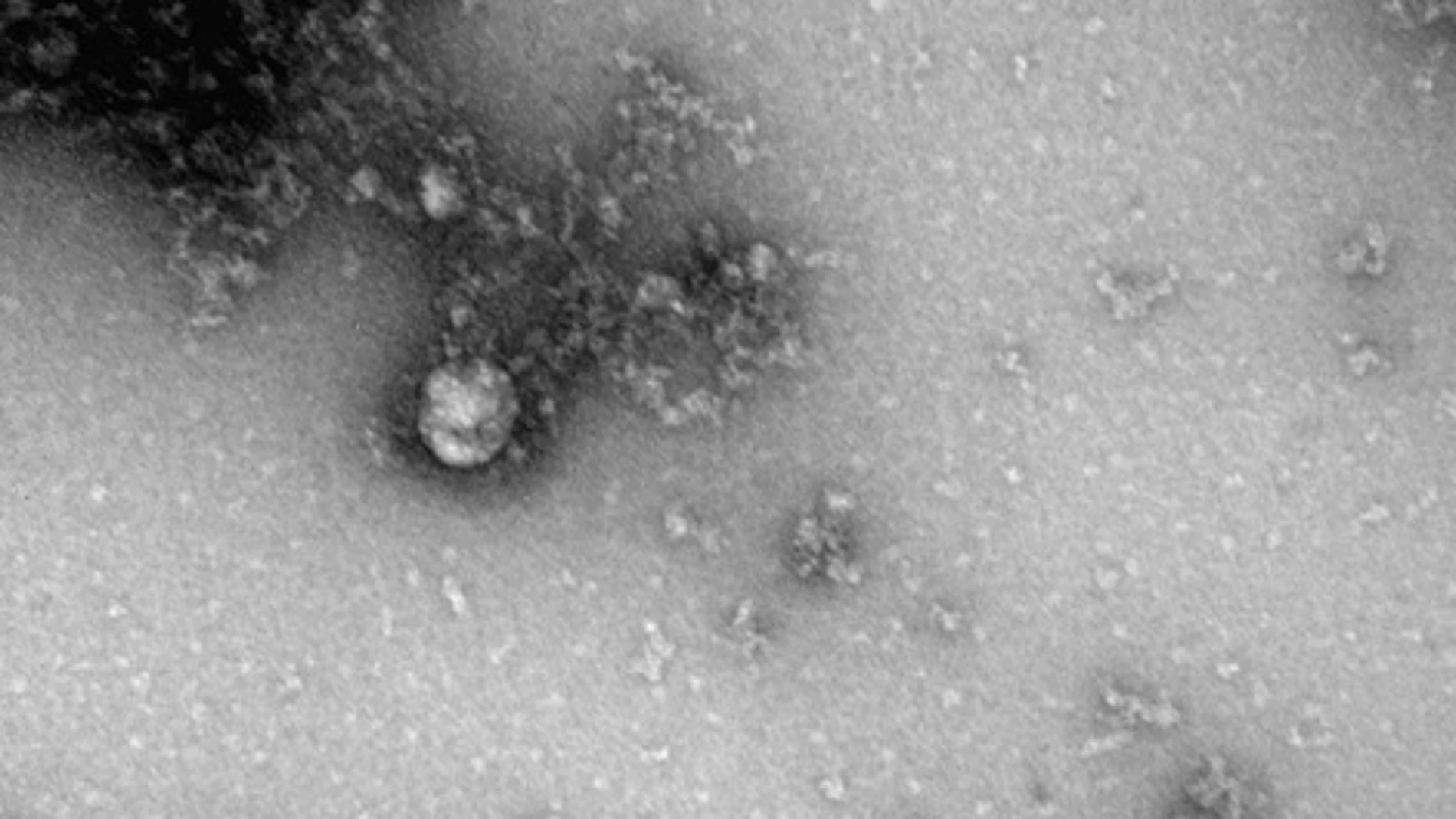 Nueva cepa británica Nueva cepa británica