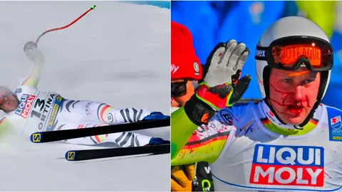 El esquiador Romed Baumann acaba con la cara ensangrentada tras este tremendo impacto en mitad de un descenso El esquiador Romed Baumann acaba con la cara ensangrentada tras este tremendo impacto en mitad de un descenso