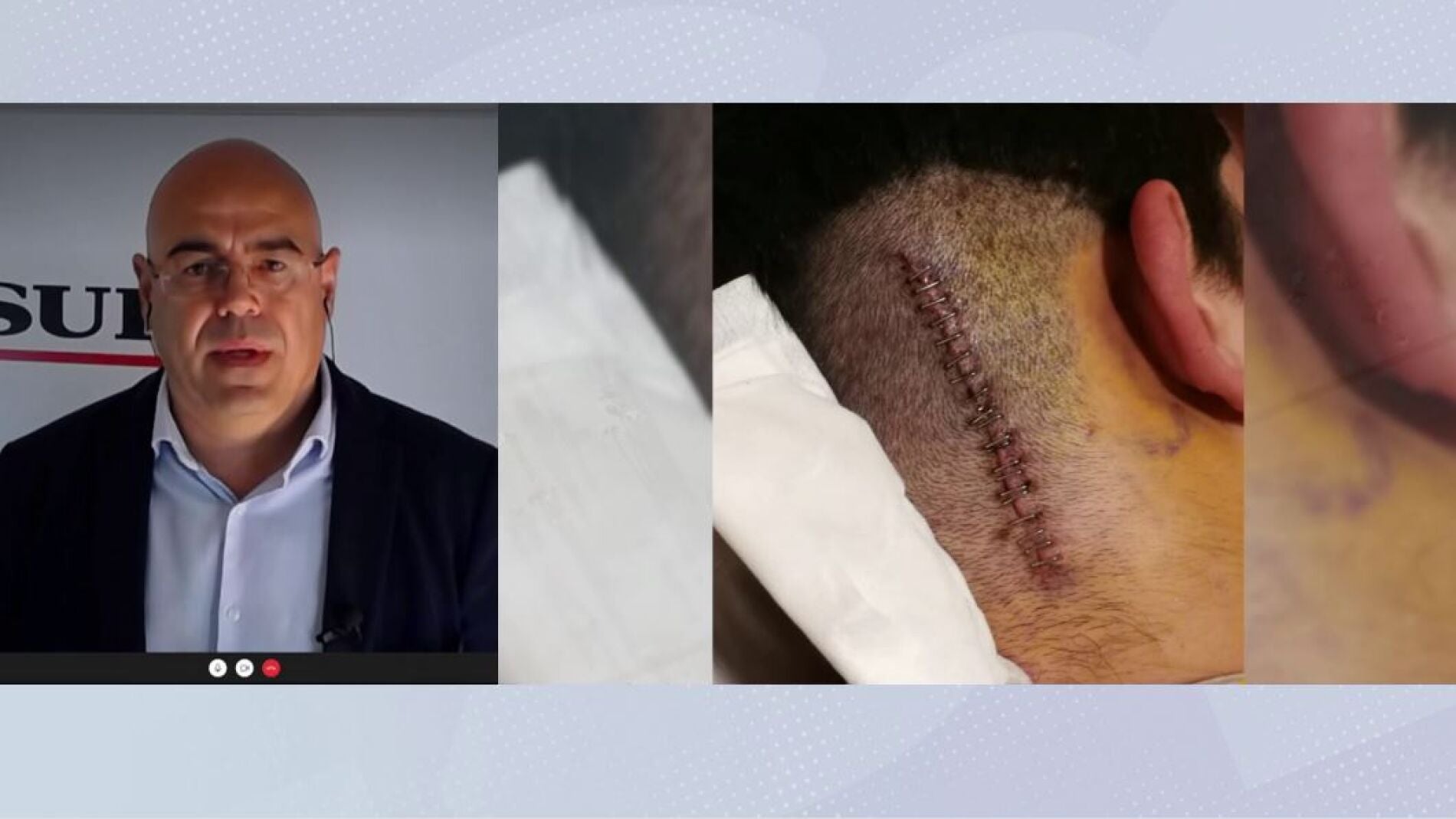 Agresi&oacute;n a un menor en M&aacute;laga.