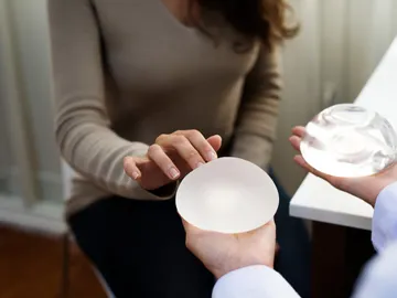 Un médico muestra tipos de implantes de pecho a una mujer. Un médico muestra tipos de implantes de pecho a una mujer.