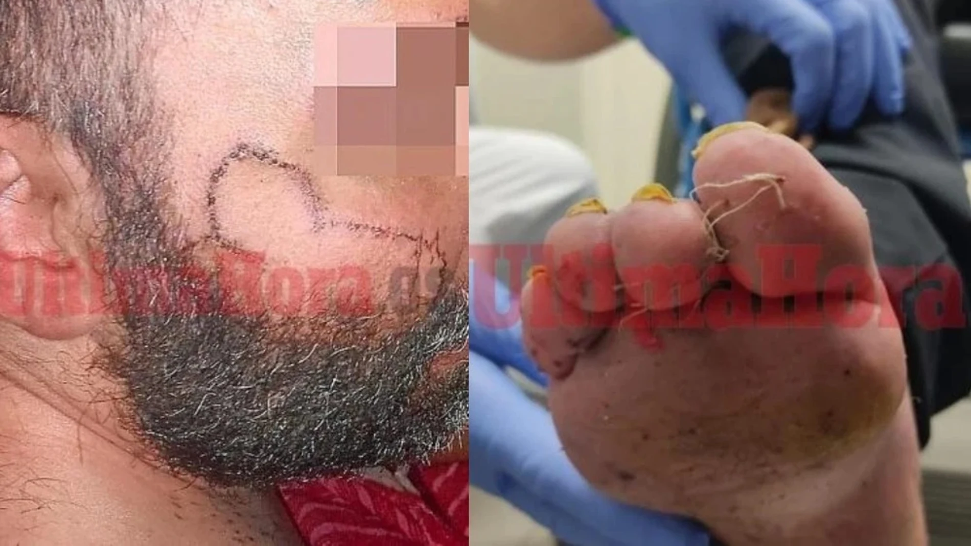 Víctima de maltratos y secuestro en Manacor Víctima de maltratos y secuestro en Manacor