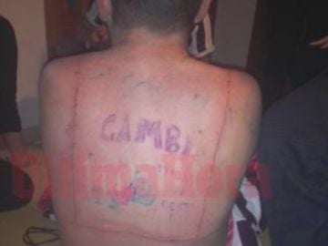 Víctima de torturas en Manacor