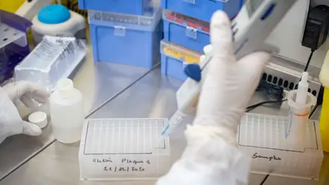 Investigación coronavirus: Descubierto un biomarcador capaz de predecir la supervivencia de un paciente de coronavirus Investigación coronavirus: Descubierto un biomarcador capaz de predecir la supervivencia de un paciente de coronavirus