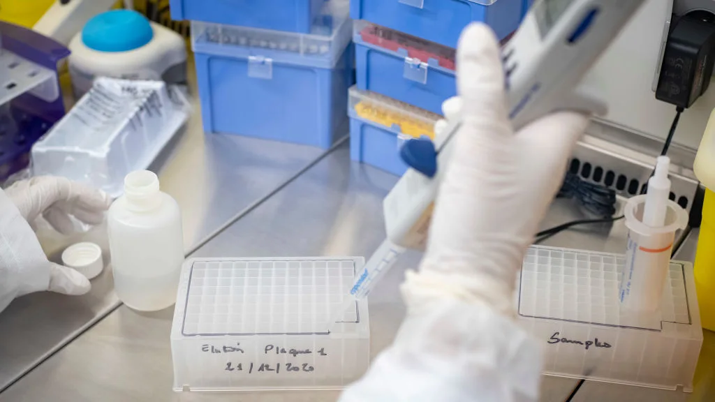 Investigaci&oacute;n coronavirus: Descubierto un biomarcador capaz de predecir la supervivencia de un paciente de coronavirus