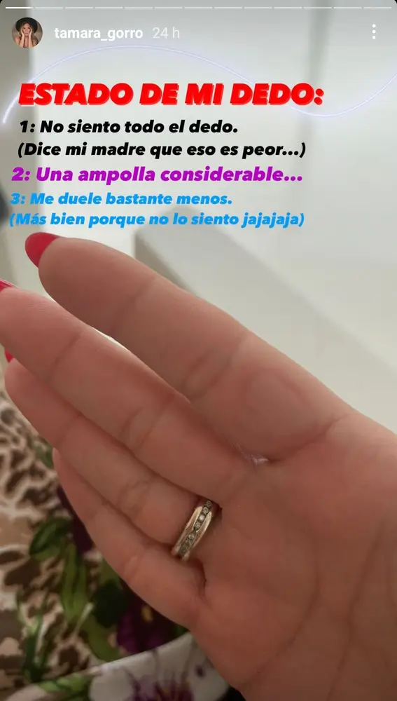 El dedo de Tamara Gorro