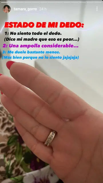 El dedo de Tamara Gorro El dedo de Tamara Gorro