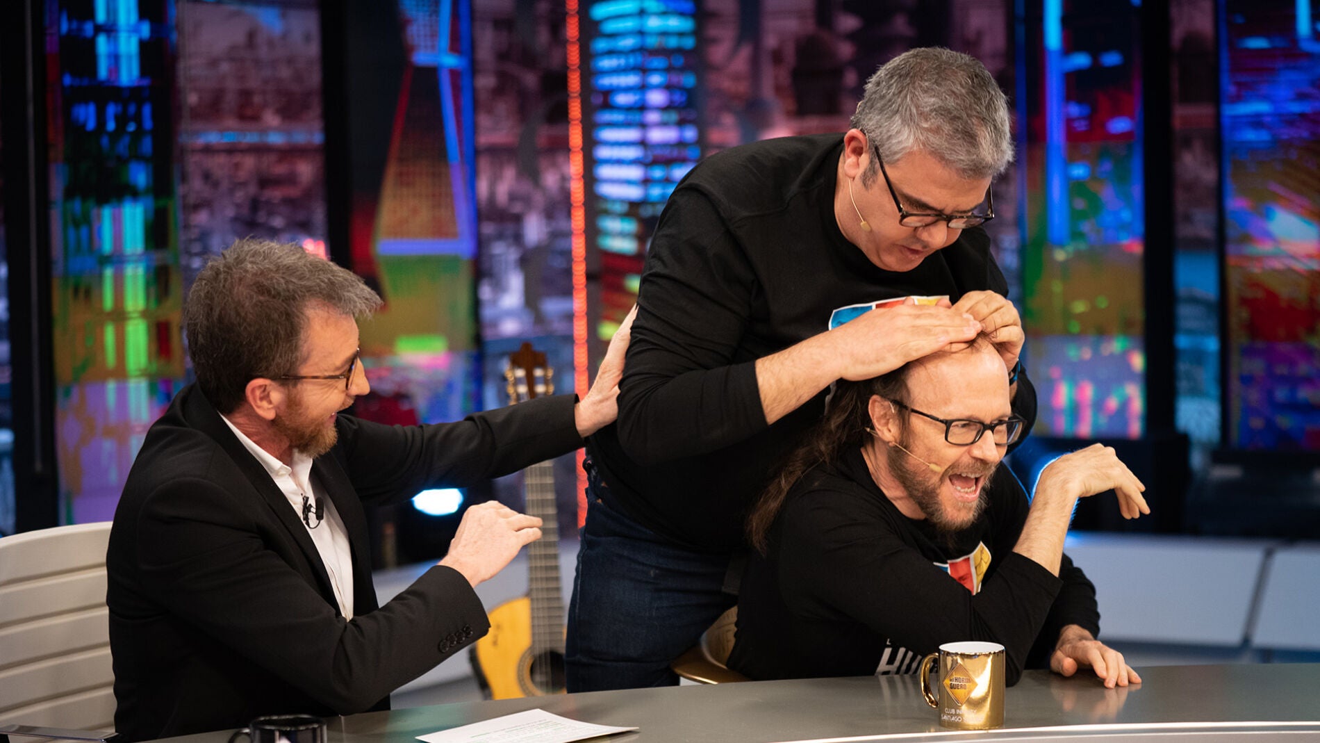 &iquest;Se ha planteado ir a Turqu&iacute;a? Santiago Segura habla de pelucas, alopecia e injertos