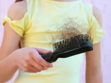 ¿A tu hijo se le cae el pelo? Descubre las razones ¿A tu hijo se le cae el pelo? Descubre las razones