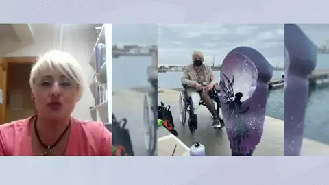 Prótesis pierna Prótesis pierna