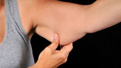 ¿Tienen solución los brazos colganderos?