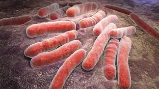 Bacterias infecciosas de tuberculosis bacterias infecciosas de tuberculosis
