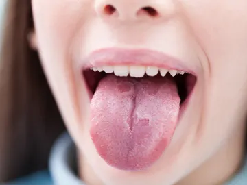 Lengua Lengua