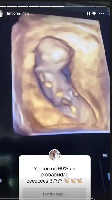 Laura Matamoros subiendo una encuesta sobre el sexo de su bebé Laura Matamoros subiendo una encuesta sobre el sexo de su bebé