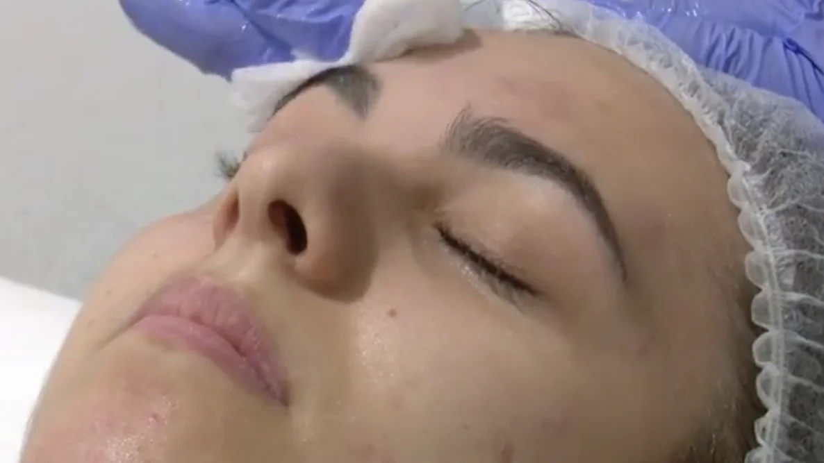 Aumenta la demanda de tratamientos faciales ante la retirada de las mascarillas al aire libre.