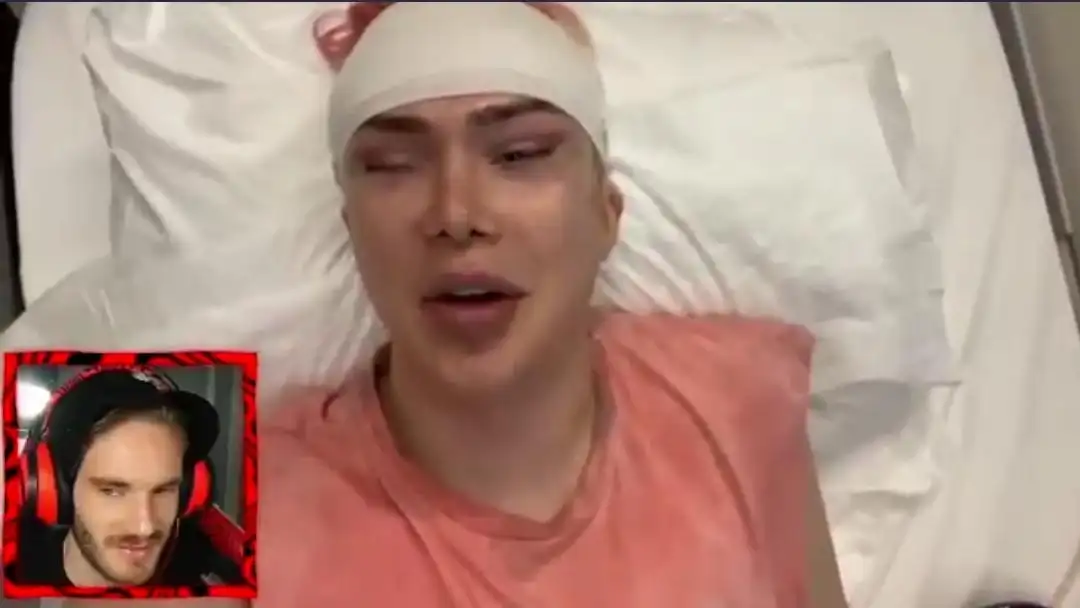 Un youtuber se somete a 18 cirugías para volverse coreano Un youtuber se somete a 18 cirugías para volverse coreano