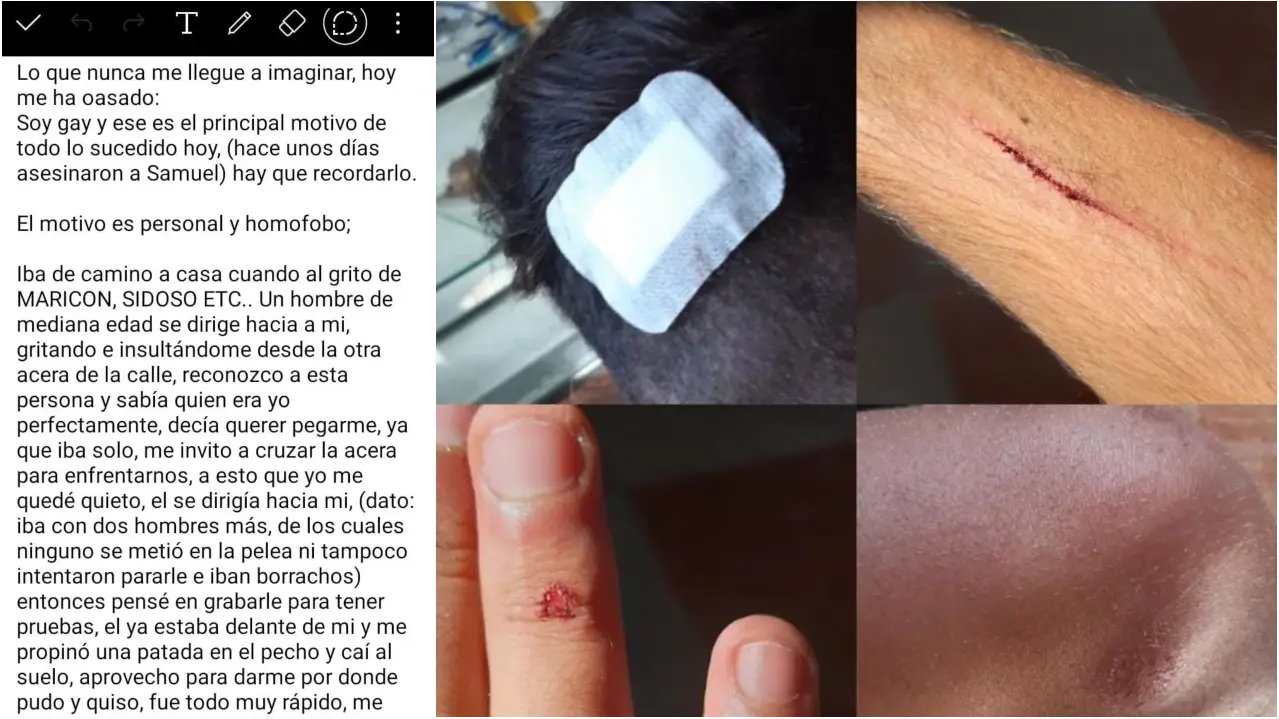 Un hombre propina una paliza a un joven al grito de "maricón, sidoso" en Huelva Un hombre propina una paliza a un joven al grito de "maricón, sidoso" en Huelva