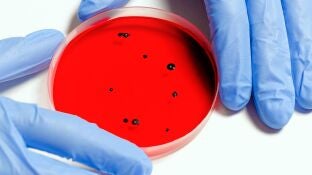 Detecci&oacute;n de norovirus
