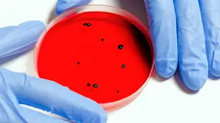 Detección de norovirus Detección de norovirus