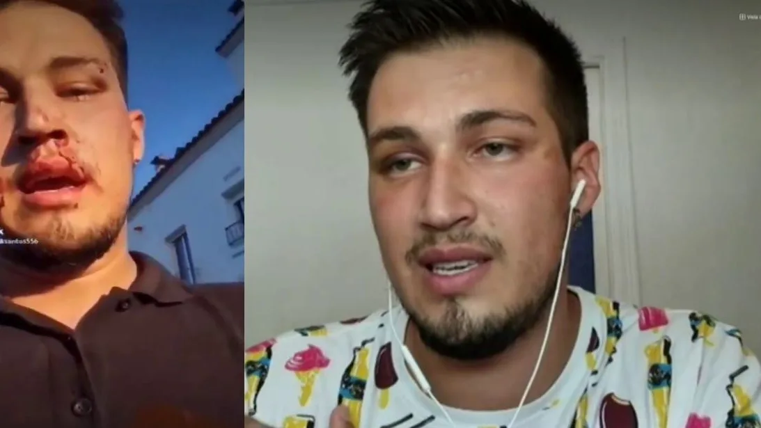 Agresi&oacute;n hom&oacute;foba a un joven.
