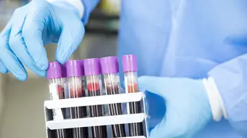 China baraja analizar muestras de sangre de Wuhan previas al primer brote de coronavirus China baraja analizar muestras de sangre de Wuhan previas al primer brote de coronavirus