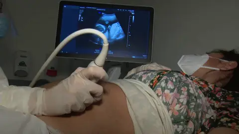 Mujeres embarazadas vacunación COVID-19 Mujeres embarazadas vacunación COVID-19