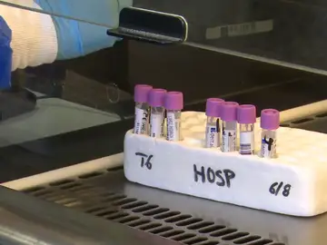 ¿Cuánto han aumentado los positivos de la variante Delta del coronavirus y cómo se identifican? ¿Cuánto han aumentado los positivos de la variante Delta del coronavirus y cómo se identifican?