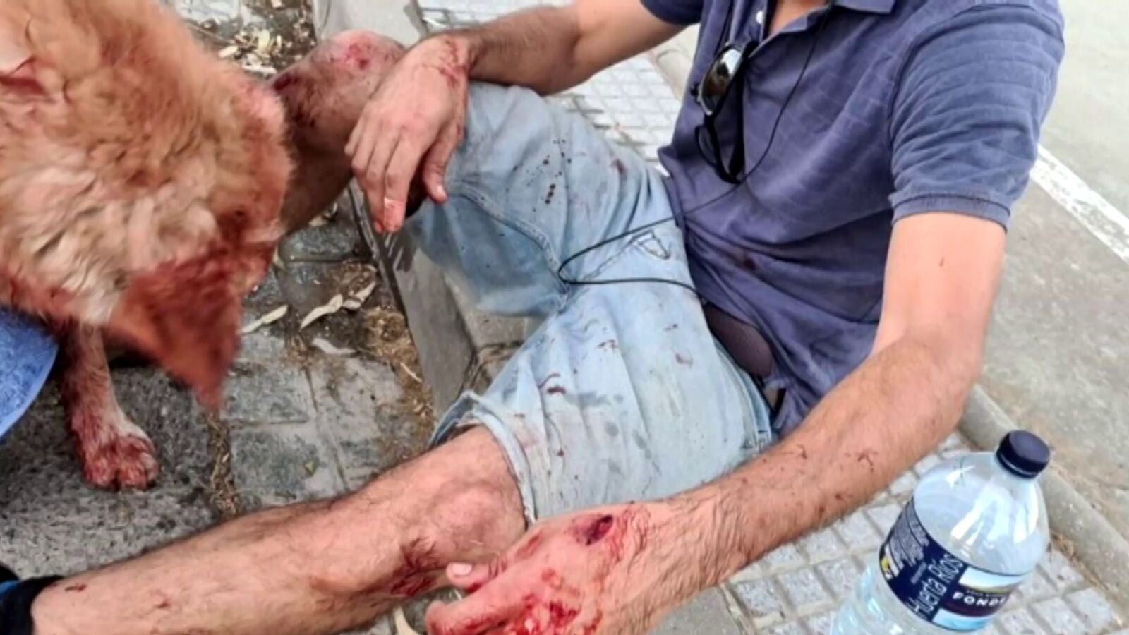 Varios perros atacan a un hombre y a su mascota mientras daban un paseo en Rota